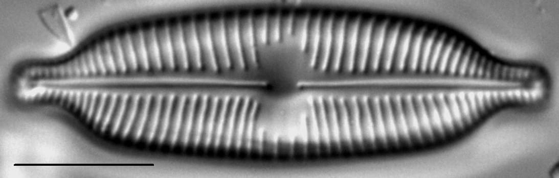 Cymbopleura elliptica LM7