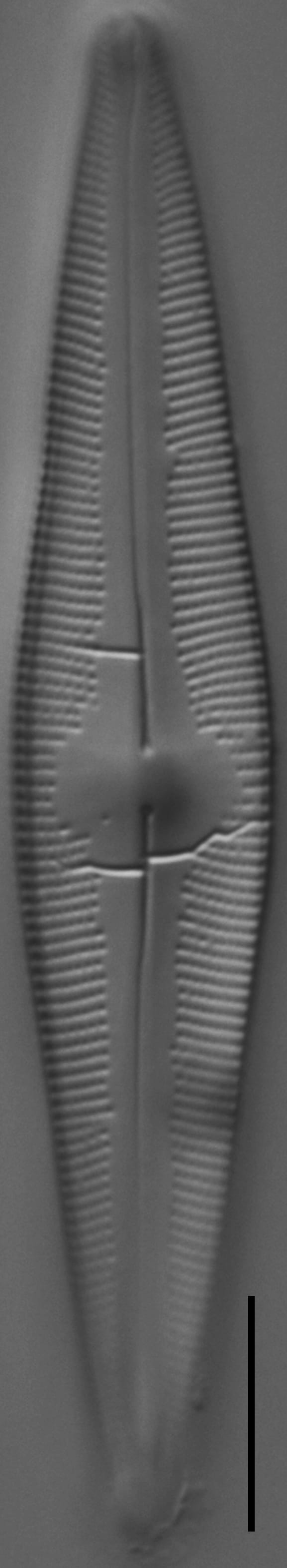 Cymbopleura stauroneiformis LM1