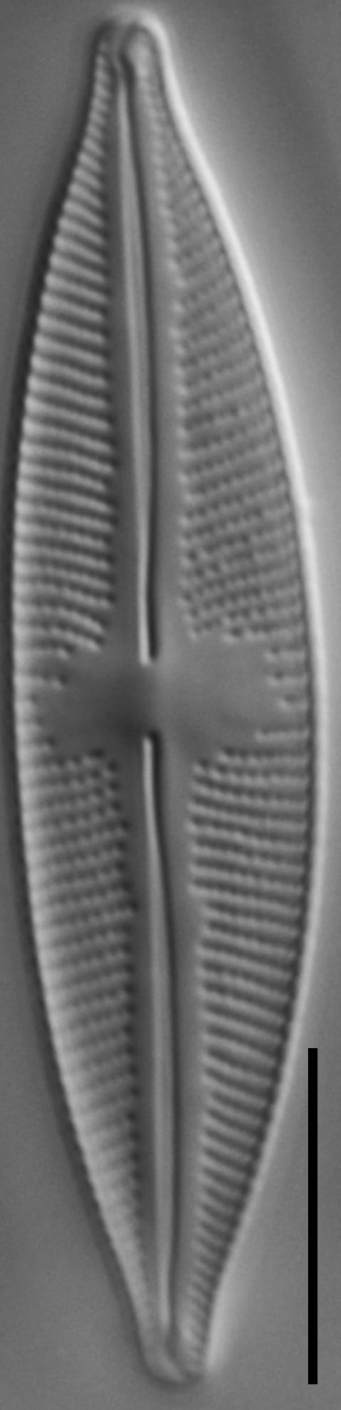 Cymbopleura stauroneiformis LM5