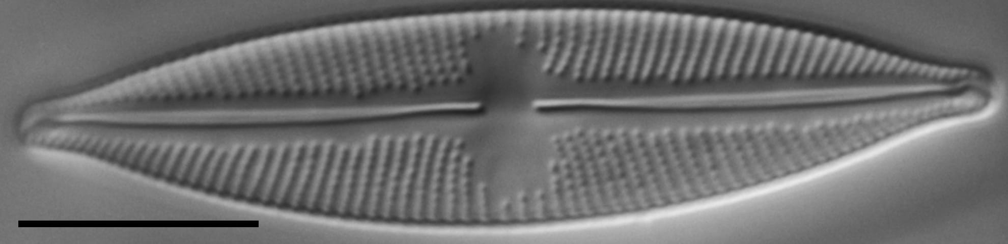 Cymbopleura stauroneiformis LM5