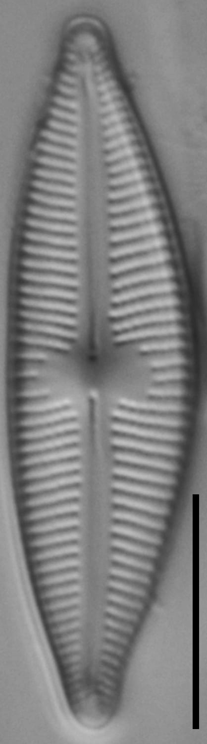 Cymbopleura stauroneiformis LM7