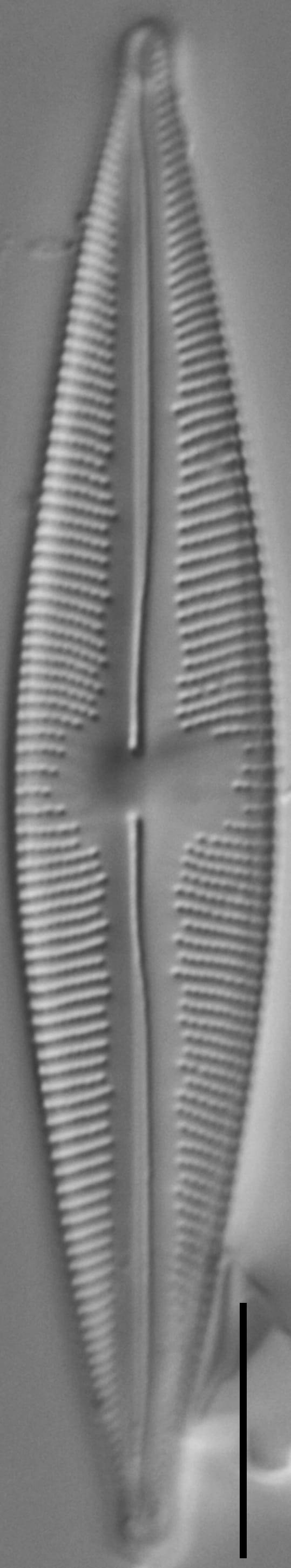 Cymbopleura stauroneiformis LM2