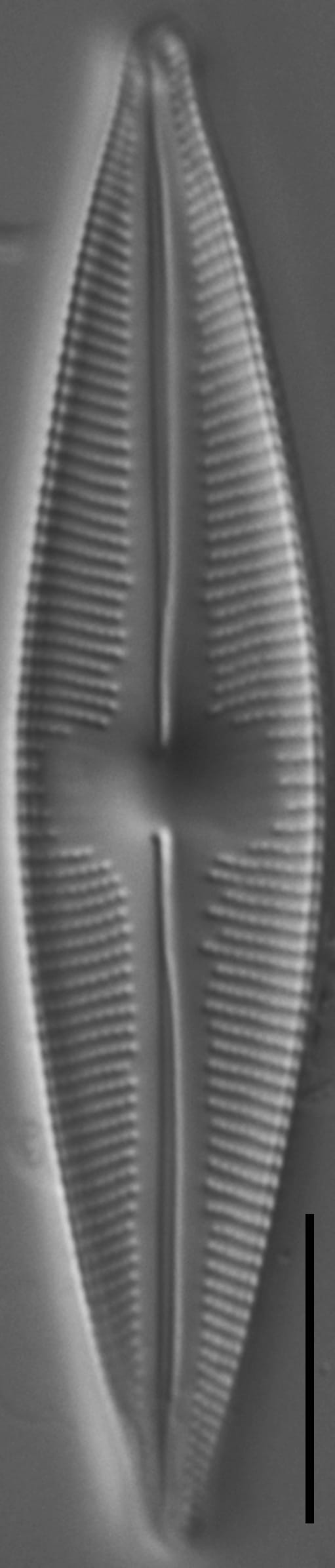 Cymbopleura stauroneiformis LM3