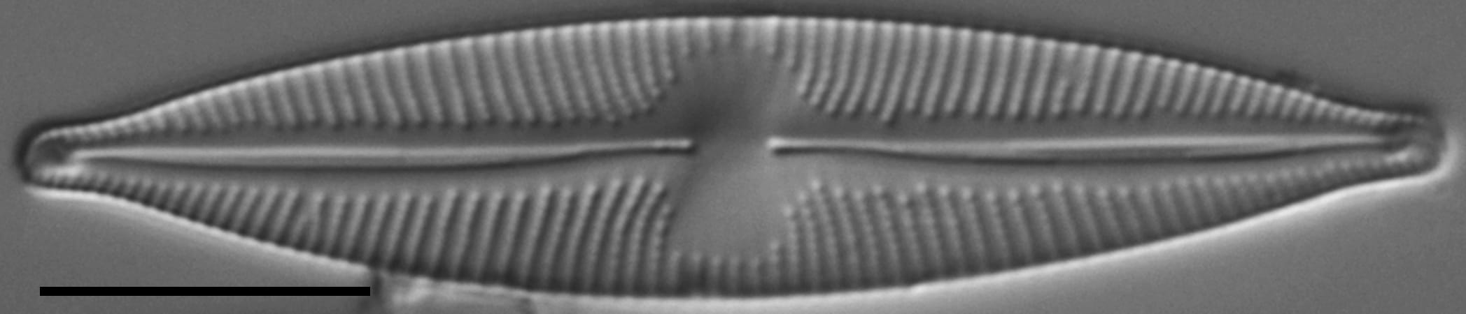 Cymbopleura stauroneiformis LM4