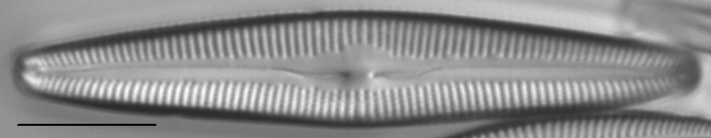 Cymbopleura florentina LM5