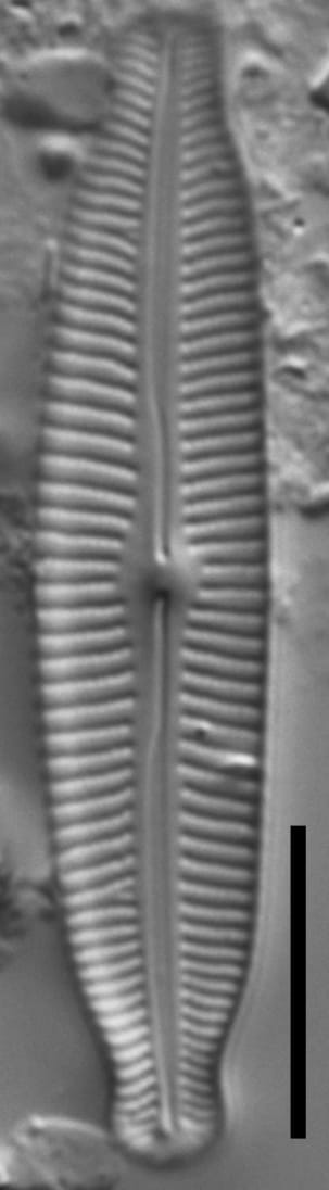 Cymbopleura linearis LM5