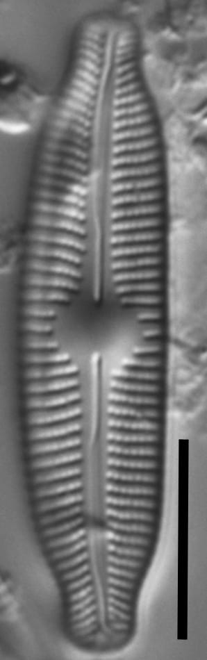 Cymbopleura linearis LM7