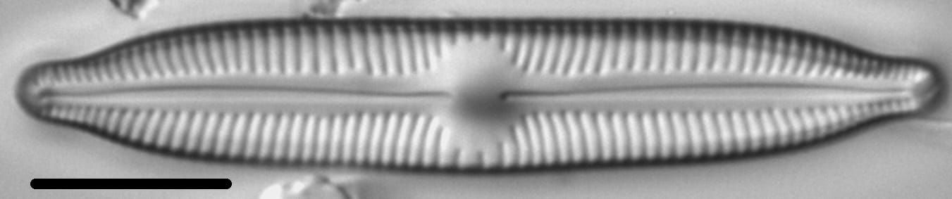 Cymbopleura hybrida LM1