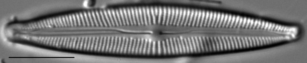 Cymbopleura Incertiformis 0 5