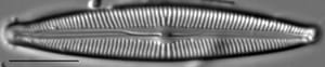 Cymbopleura Incertiformis 0 5
