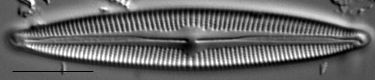 Cymbopleura Incertiformis 1