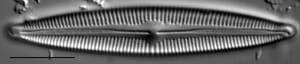Cymbopleura Incertiformis 1