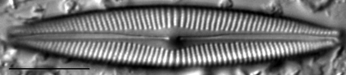 Cymbopleura Incertiformis 2