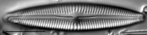 Cymbopleura Incertiformis 4