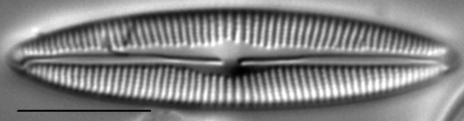 Cymbopleura Incertiformis 7