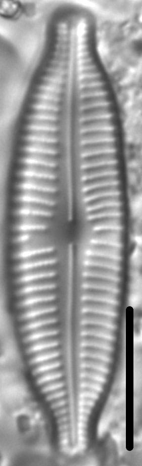 Cymbopleura Similiformis 1