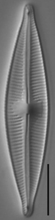 Cymbopleura Stauroneiformis  Wet Ak506 Final