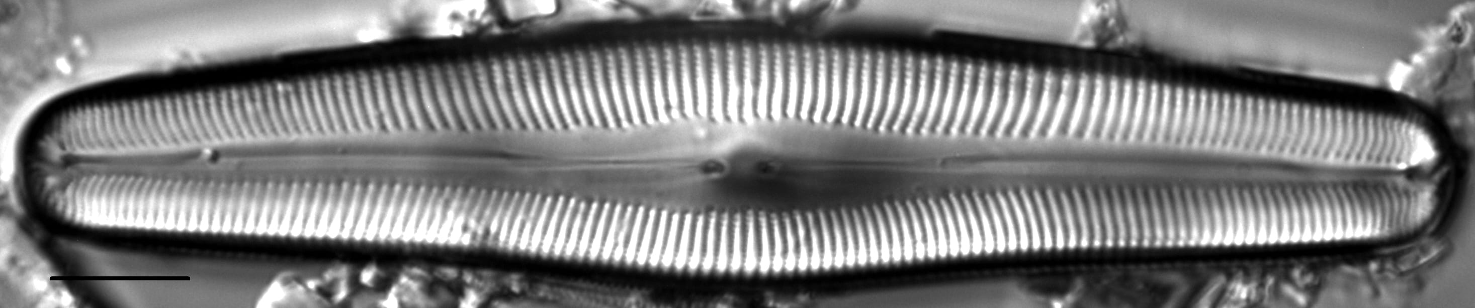 Cymbopleura anglica LM1