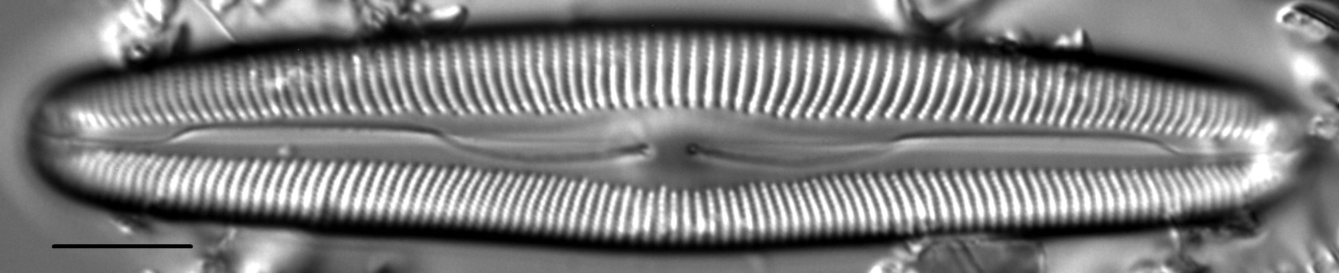 Cymbopleura anglica LM2