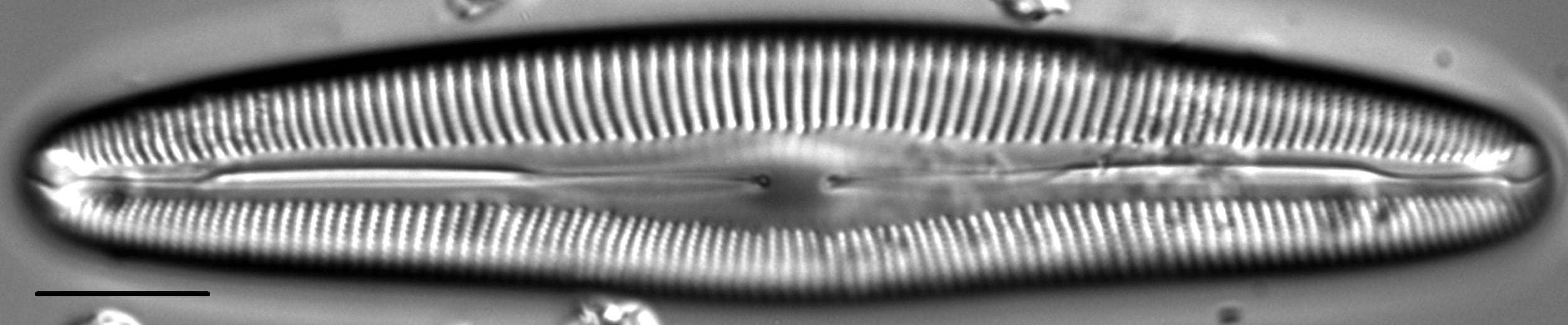 Cymbopleura anglica LM3