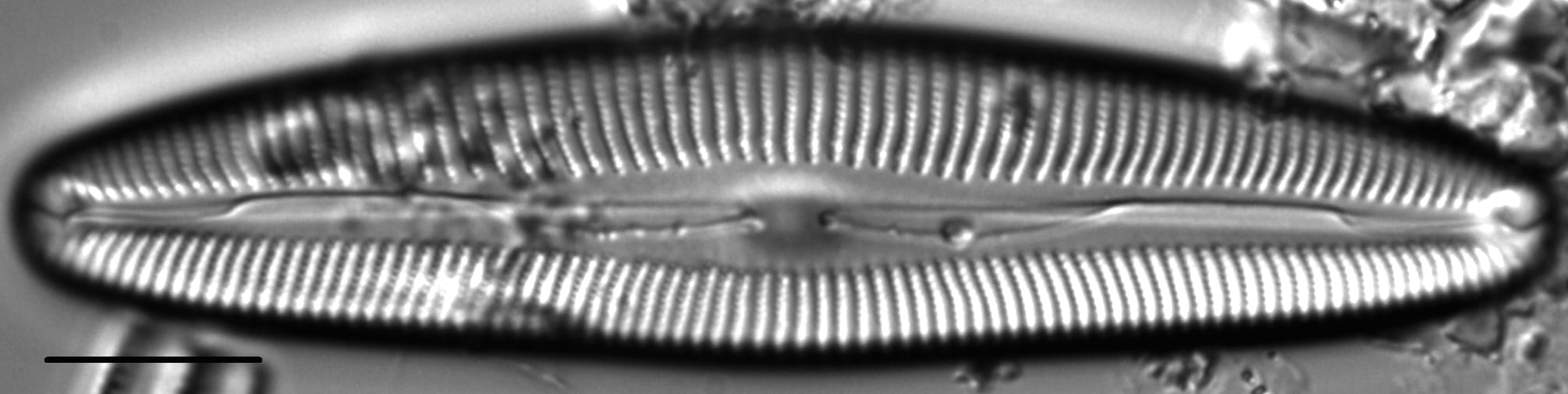 Cymbopleura anglica LM5