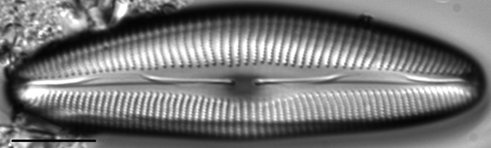 Cymbopleura anglica LM6