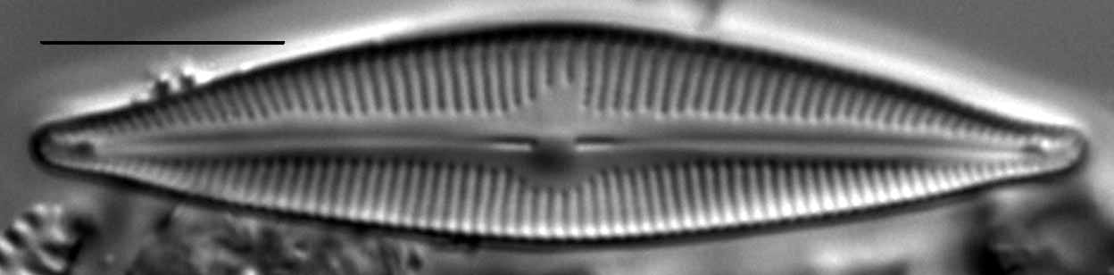 Cymbopleura lapponica LM1