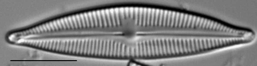 Cymbopleura lapponica LM3