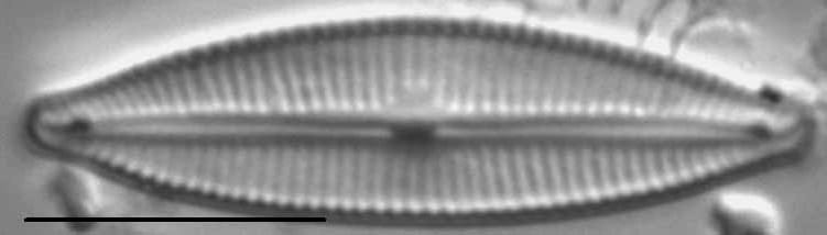 Cymbopleura lapponica LM5