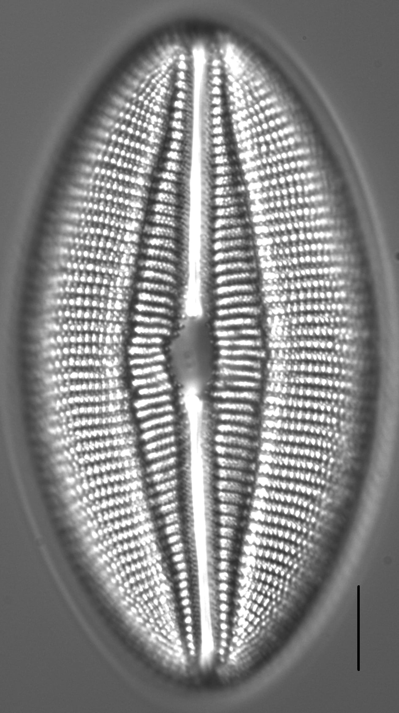 Diploneis finnica LM1