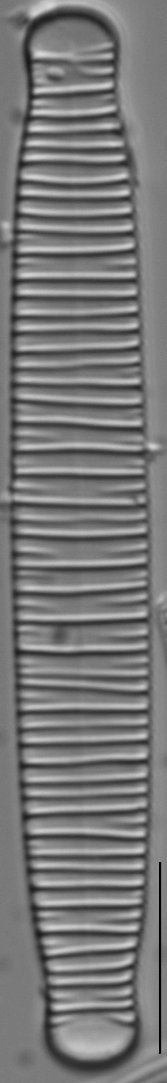 Diatoma Ehrenbergii 18 Rotated 2  Nydec15 P054