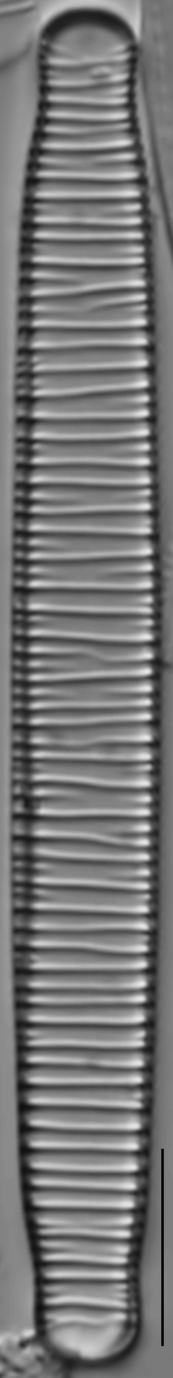 Diatoma Ehrenbergii 19 Rotated 2  Nydec15 P054 Stitched