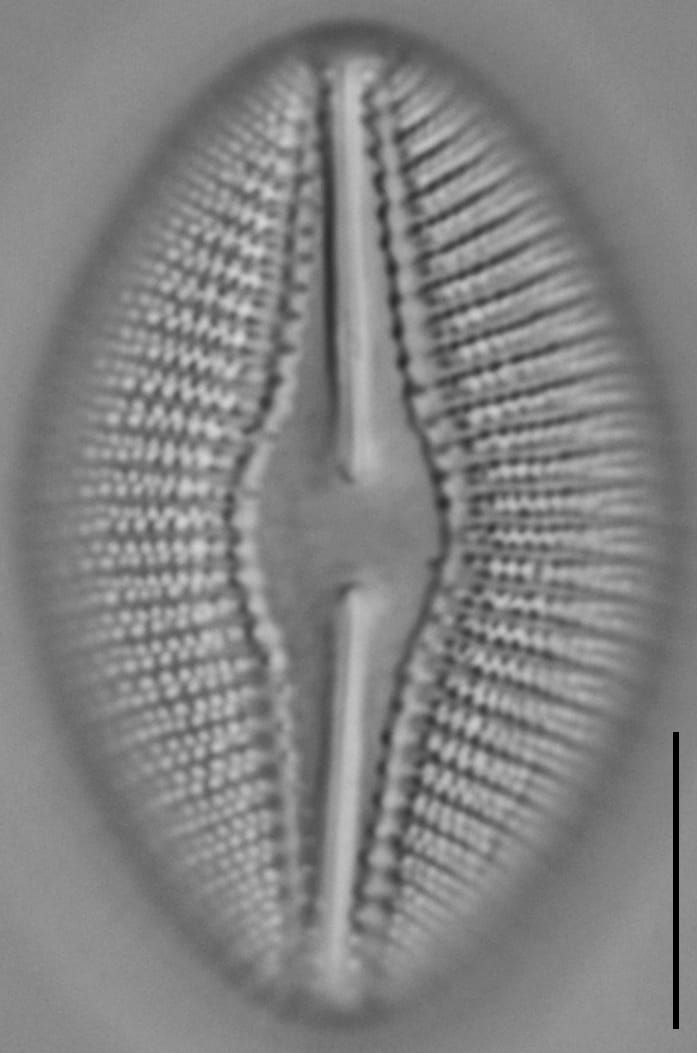 Diploneis dilatata LM1