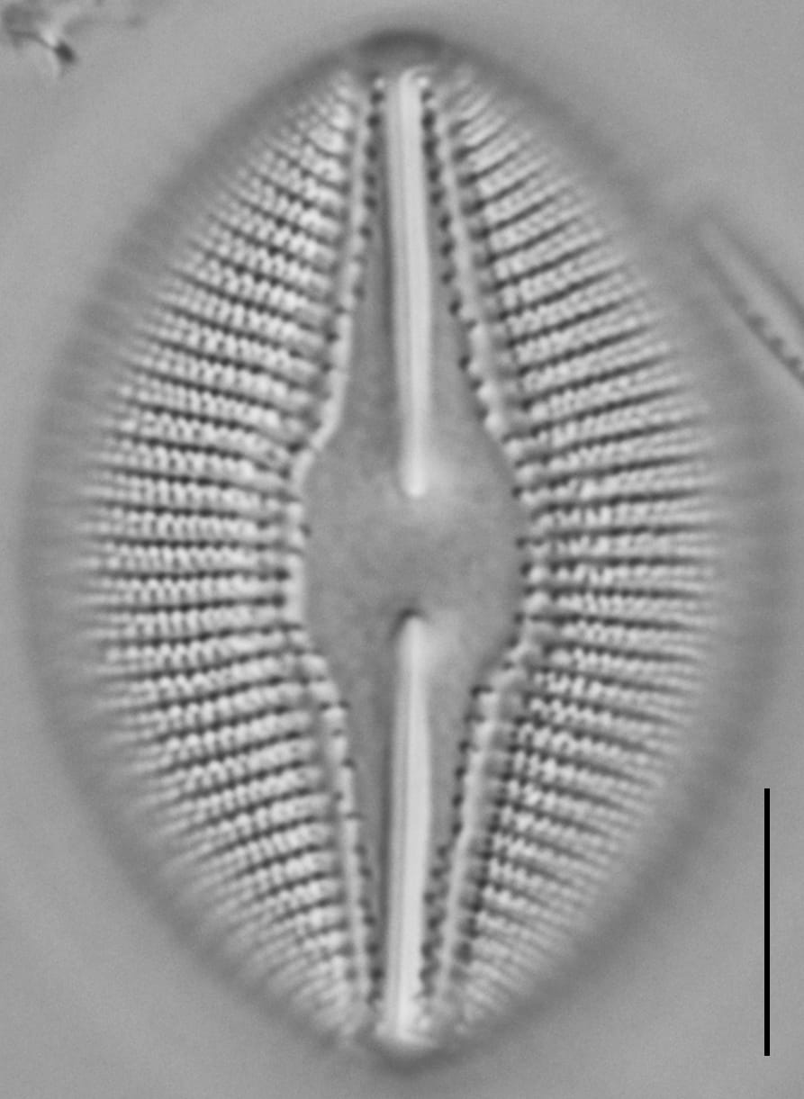 Diploneis dilatata LM2