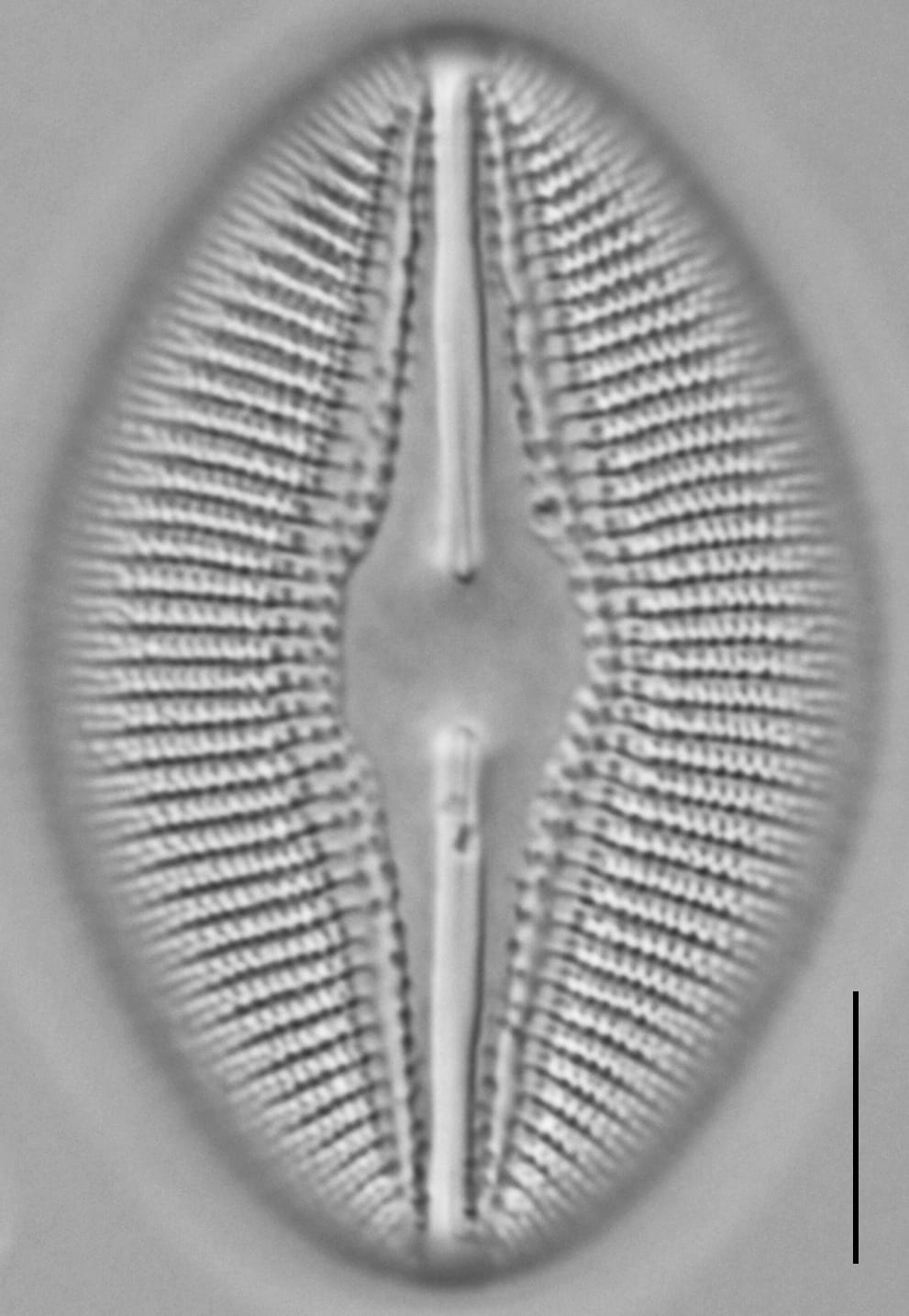 Diploneis dilatata LM3