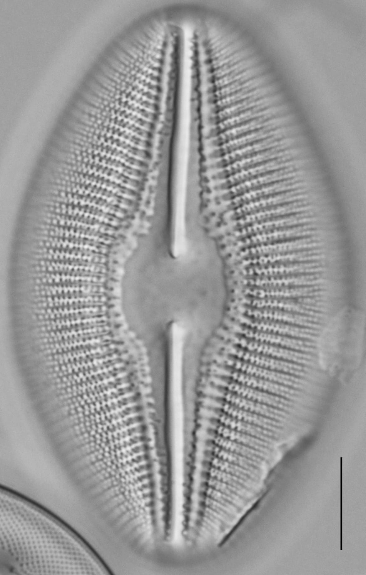 Diploneis dilatata LM6