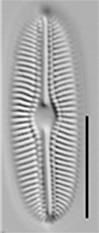 Diploneis fontanella LM1