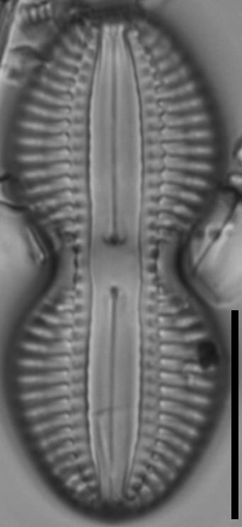 Diploneis interrupta LM2