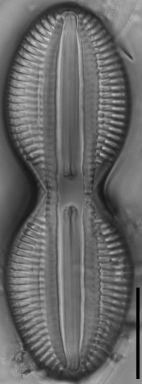 Diploneis interrupta LM7