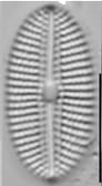 Diploneis Voigtiana Lm6