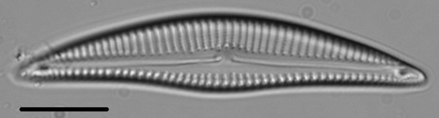 Encyonema silesiacum var elegans LM1