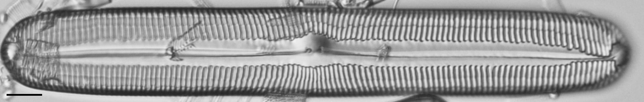 Pinnularia spinifera LM1