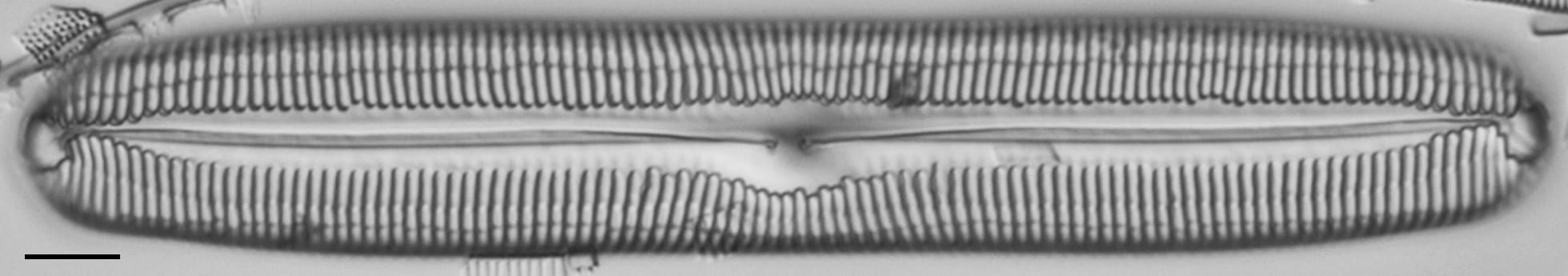 Pinnularia spinifera LM2