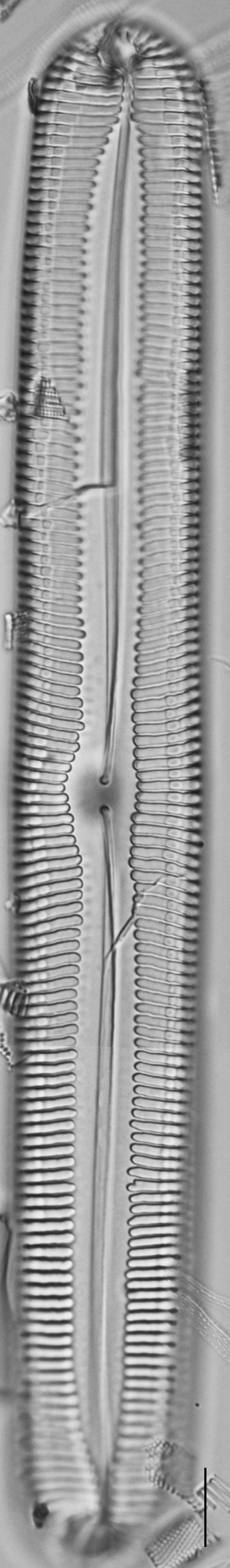 Pinnularia spinifera LM6