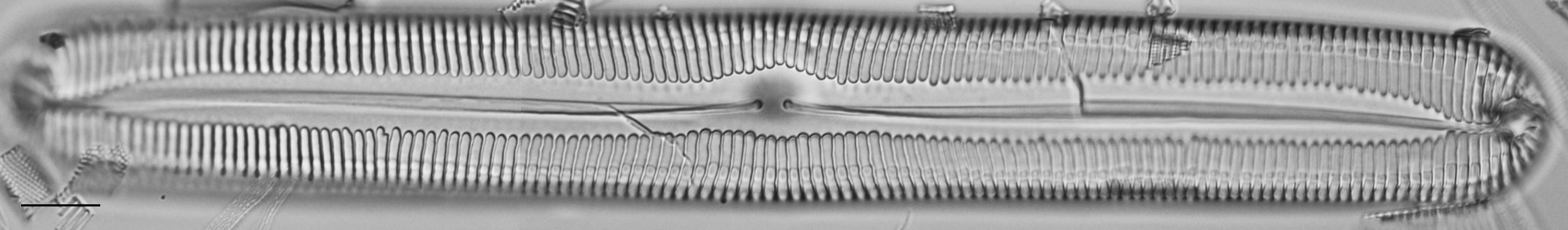 Pinnularia spinifera LM6