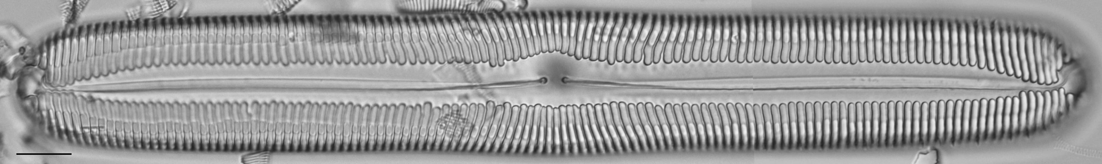 Pinnularia spinifera LM3