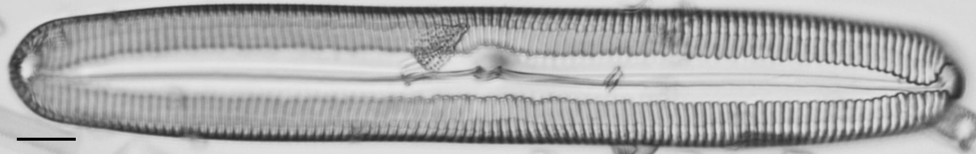 Pinnularia spinifera LM4