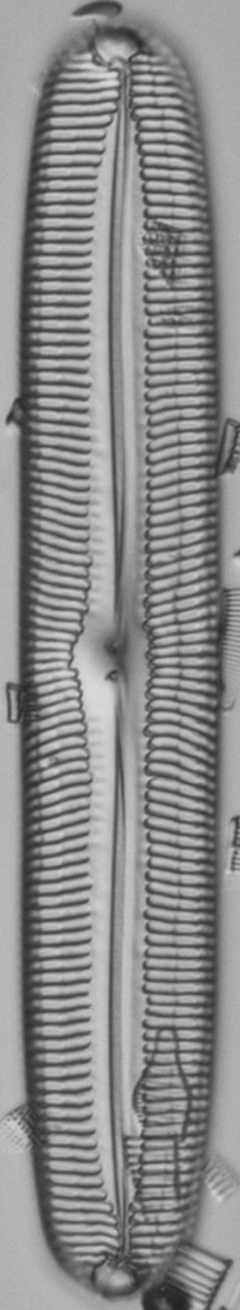 Pinnularia spinifera EM100012 TYPE8