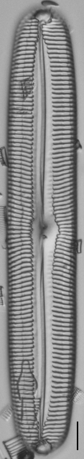 Pinnularia spinifera LM7