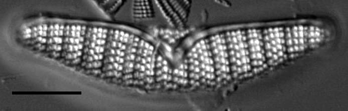 Epad Nrsa1180 6Edited